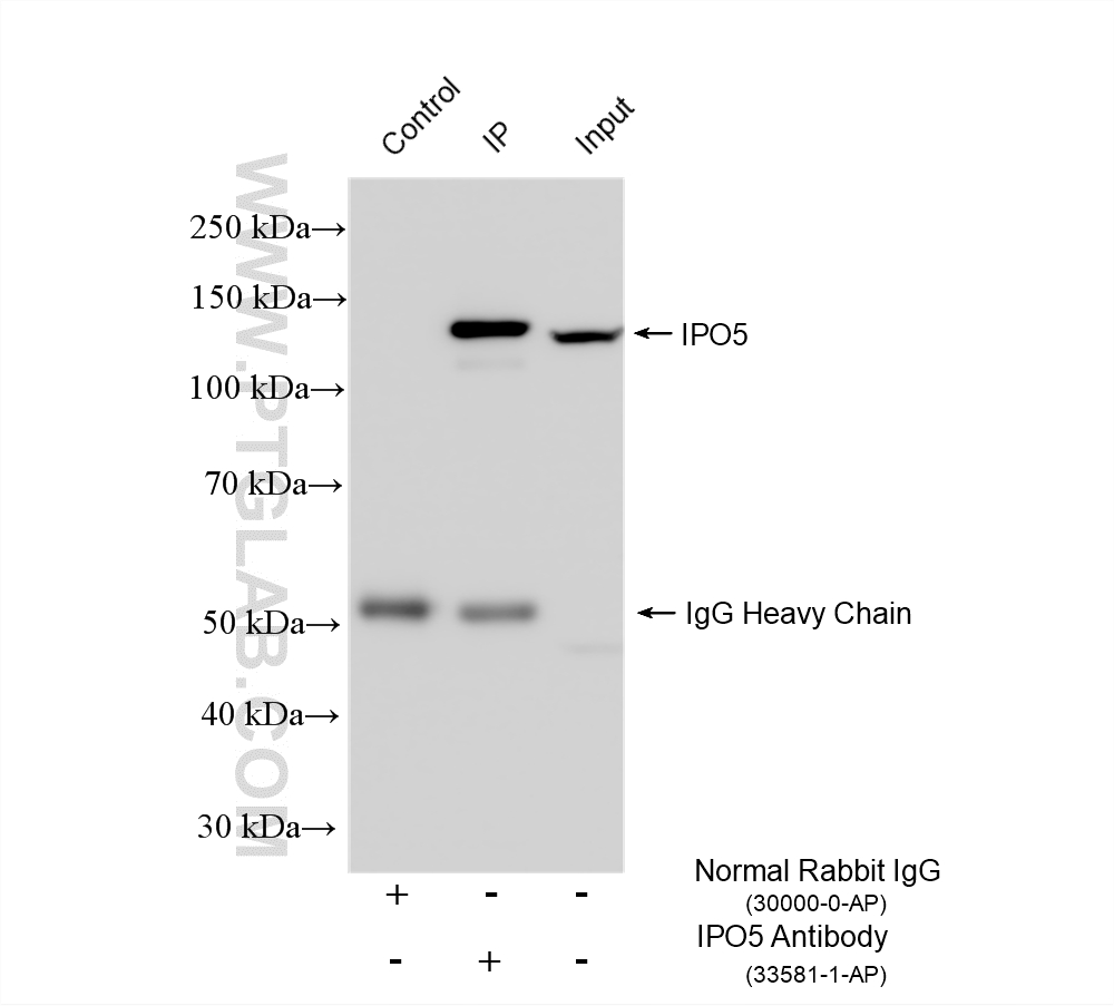 IP result of anti-IPO5 (IP:33581-1-AP, 4ug; Detection:33581-1-AP 1:600) with HeLa cells lysate 920 ug. IP experiment of HeLa using 33581-1-AP