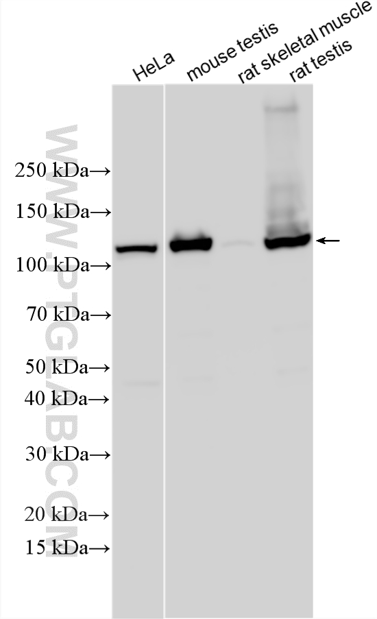Various lysates were subjected to SDS PAGE followed by western blot with 33581-1-AP (IPO5 antibody) at dilution of 1:1000 incubated at room temperature for 1.5 hours. WB analysis using 33581-1-AP