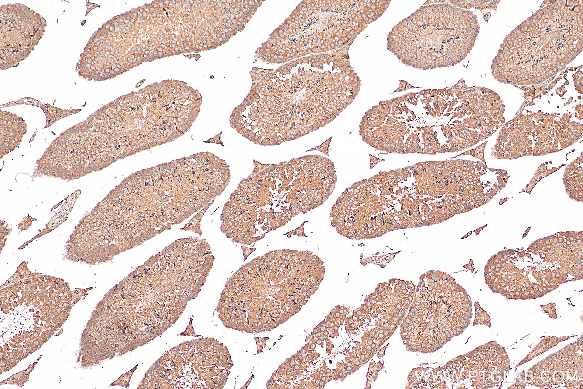IHC staining of mouse testis using 67962-1-Ig (same clone as 67962-1-PBS)