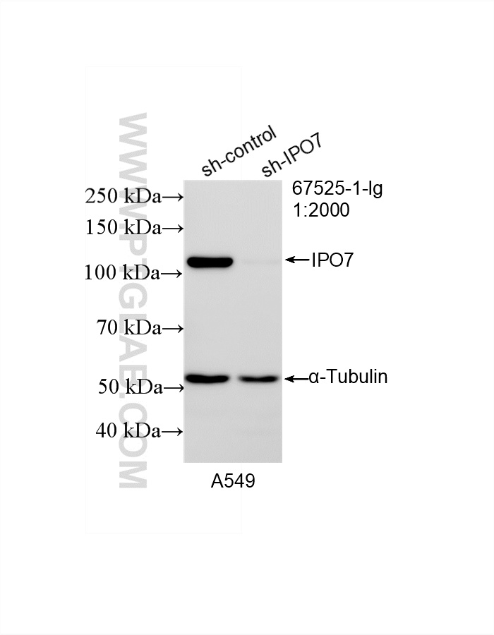 WB result of IPO7 antibody (67525-1-Ig; 1:2000; incubated at room temperature for 1.5 hours) with sh-Control and sh-IPO7 transfected A549 cells. WB analysis of A549 using 67525-1-Ig