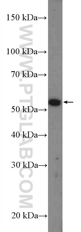 WB analysis of mouse testis using 26345-1-AP