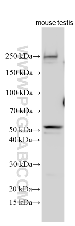 WB analysis using 33459-1-AP (same clone as 33459-1-PBS) WB analysis using 33459-1-AP (same clone as 33459-1-PBS)