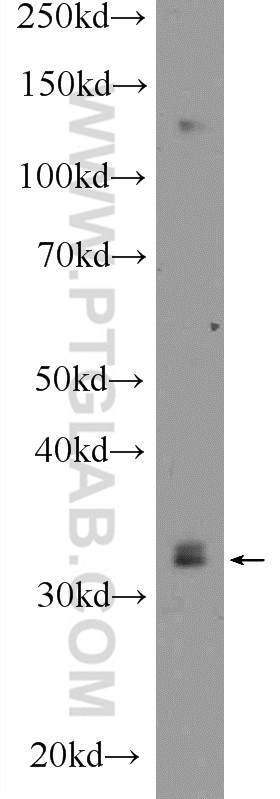 mouse testis tissue were subjected to SDS PAGE followed by western blot with 25740-1-AP (IQCK Antibody) at dilution of 1:600 incubated at room temperature for 1.5 hours. WB analysis of mouse testis using 25740-1-AP