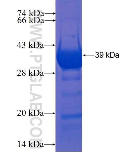 IQCK fusion protein Ag22679 SDS-PAGE IQCK fusion protein Ag22679 SDS-PAGE