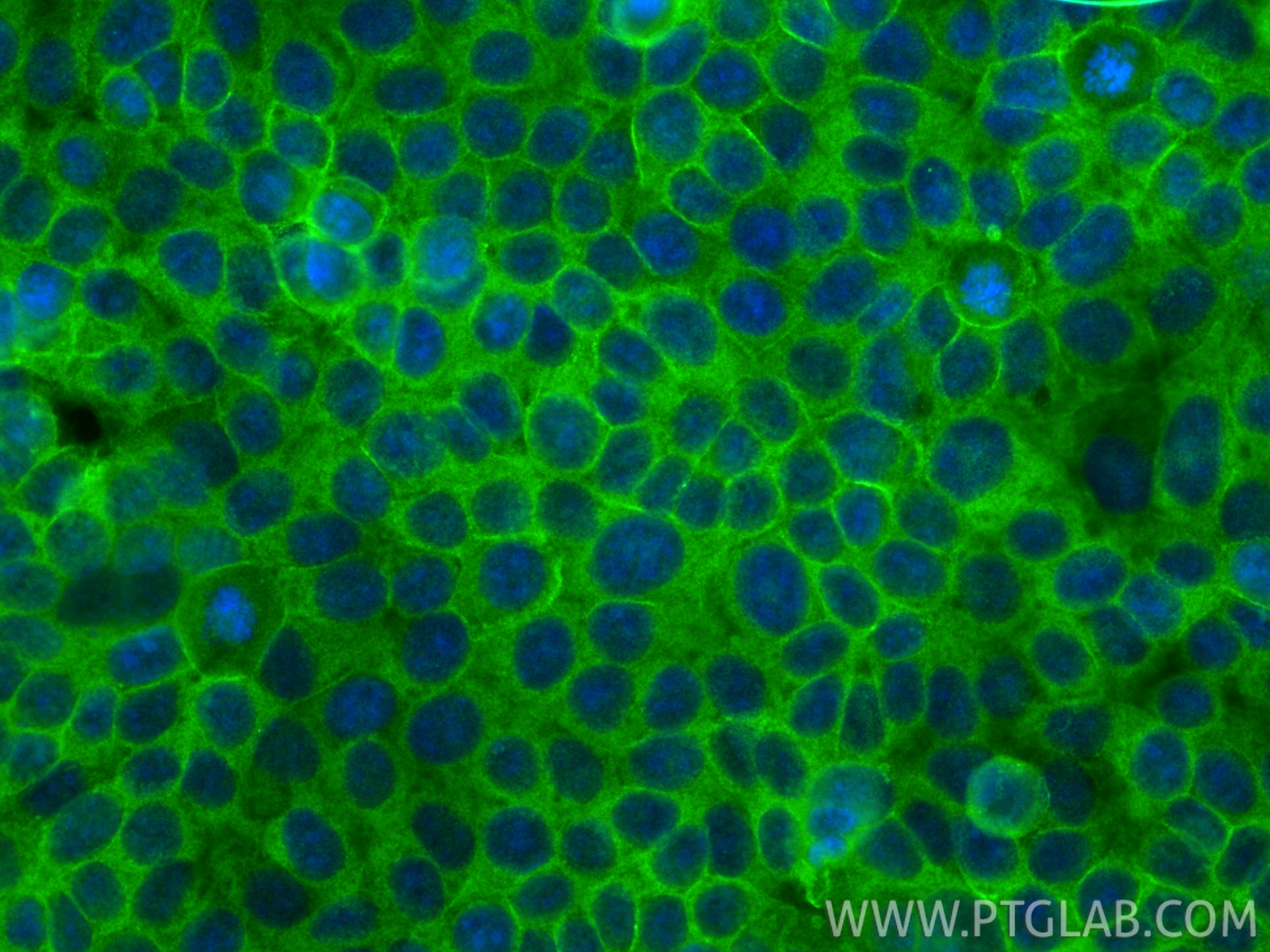 IF Staining of MCF-7 using 22167-1-AP