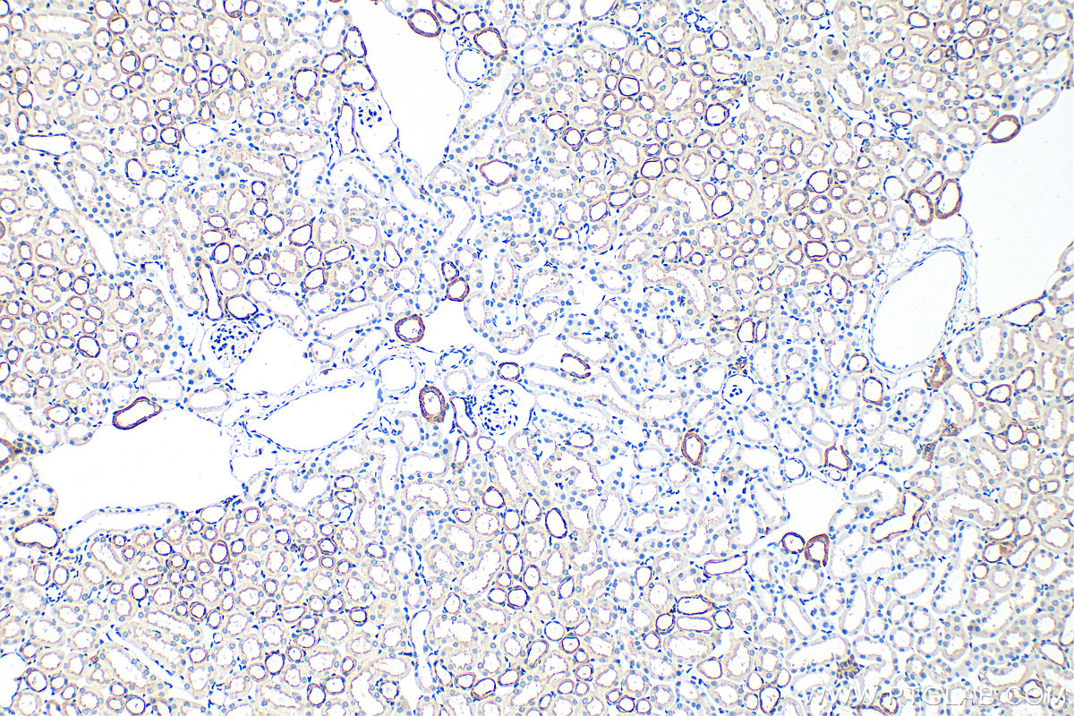 IHC staining of mouse kidney using 22167-1-AP