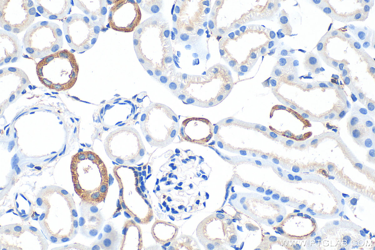 IHC staining of mouse kidney using 22167-1-AP