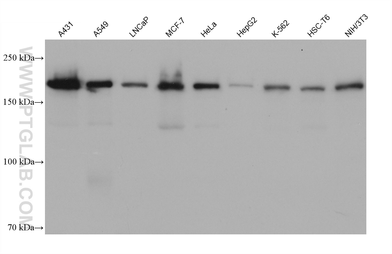 WB analysis using 68588-1-Ig