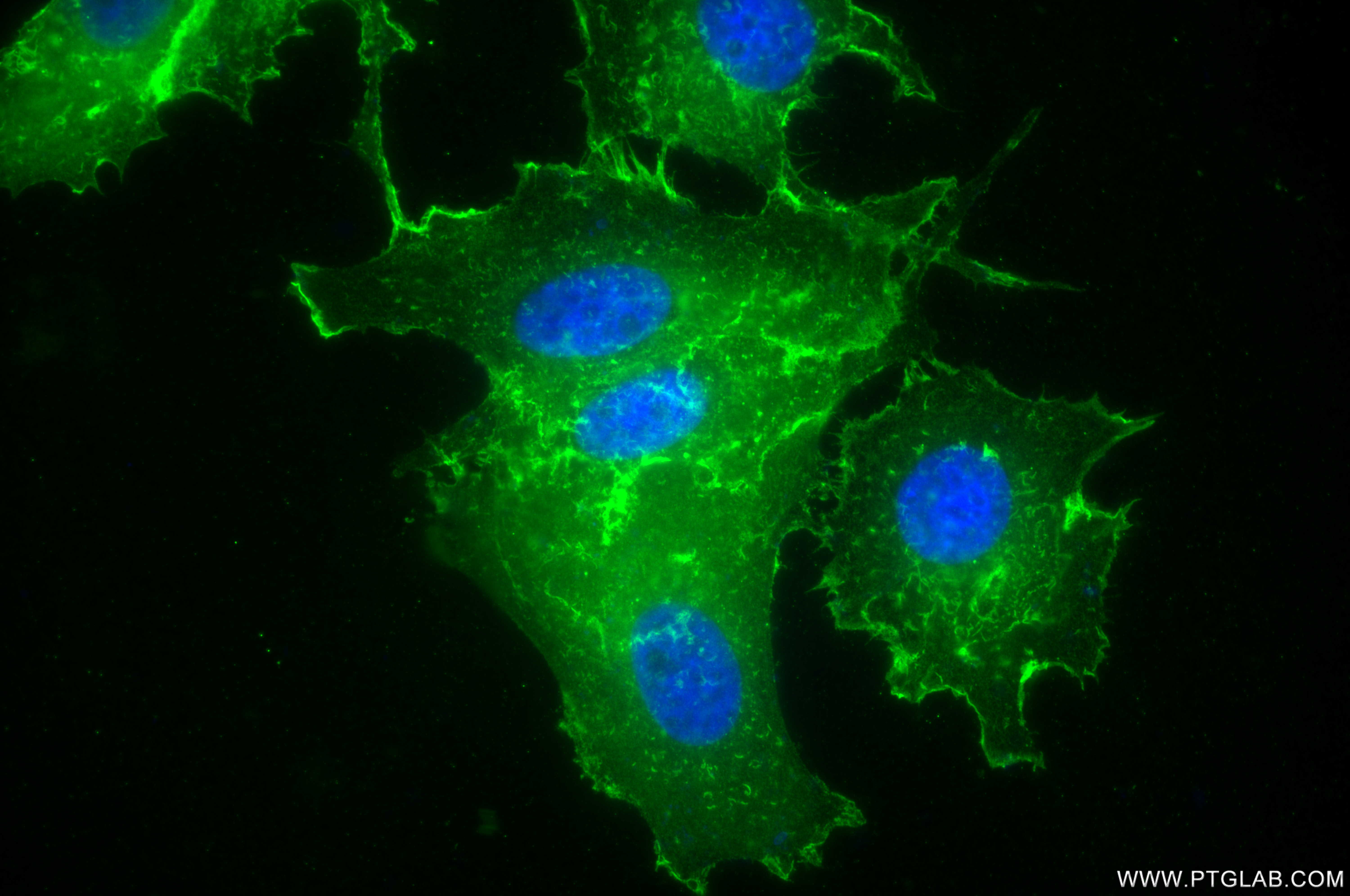 IF Staining of MCF-7 using 85651-1-RR (same clone as 85651-1-PBS)