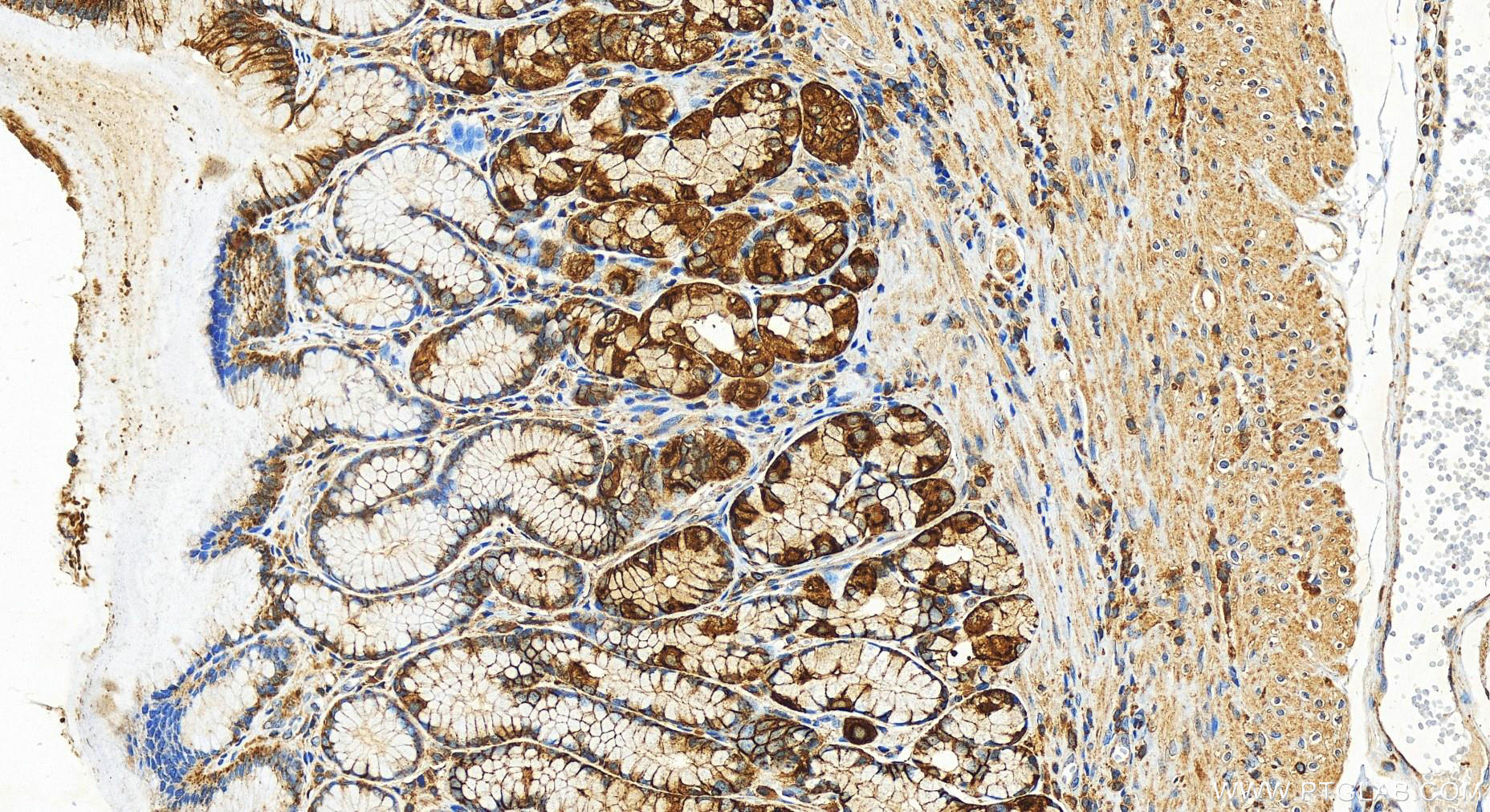 IHC staining of human stomach using 30692-1-AP