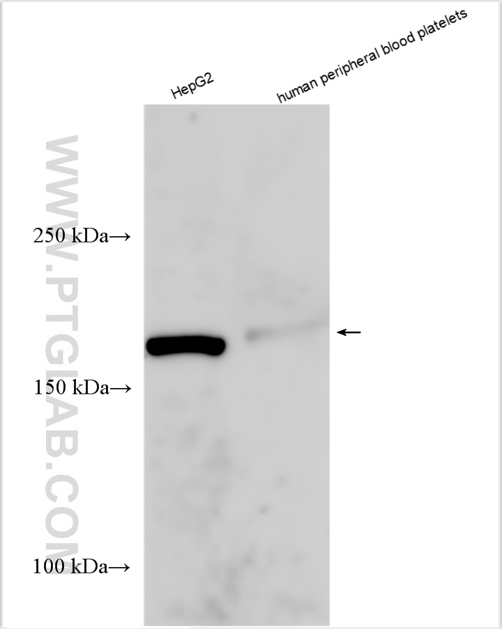 WB analysis using 55189-1-AP