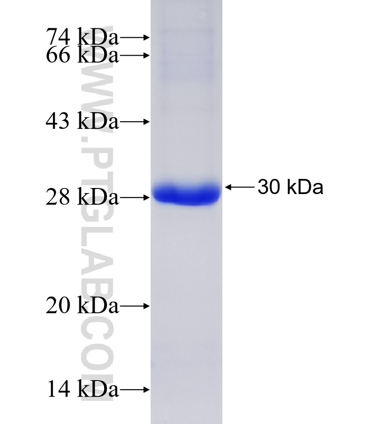 IQGAP2 fusion protein Ag33499 SDS-PAGE IQGAP2 fusion protein Ag33499 SDS-PAGE