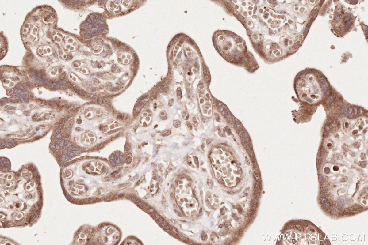 IHC staining of human placenta using 25930-1-AP