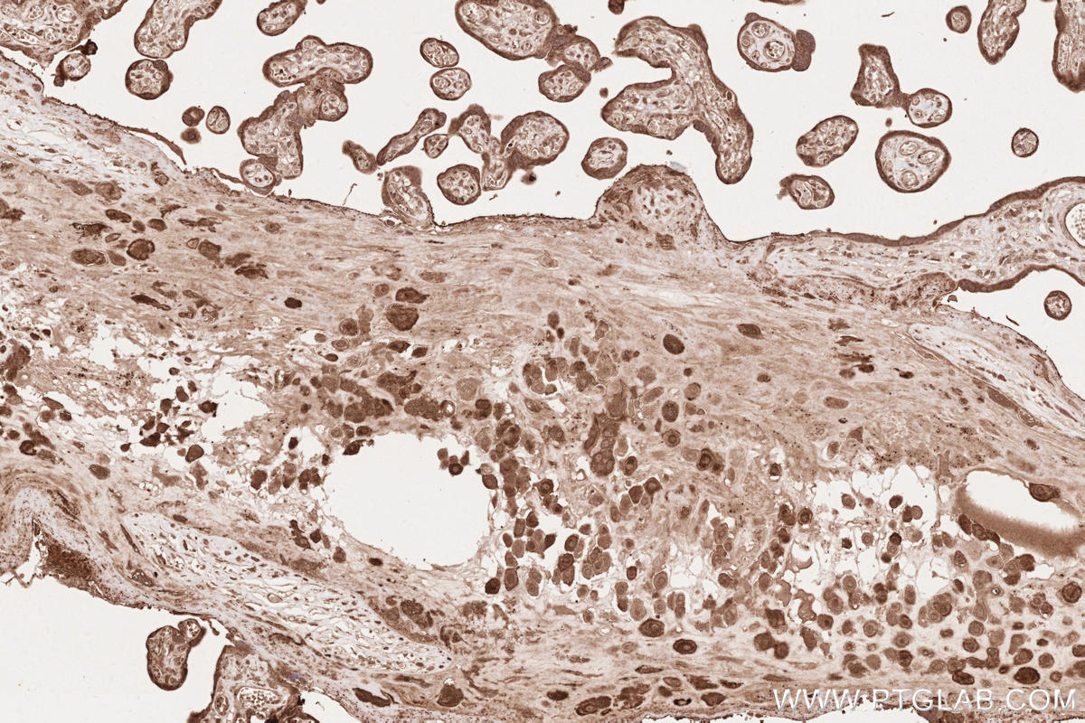 IHC staining of human placenta using 25930-1-AP IHC staining of human placenta using 25930-1-AP