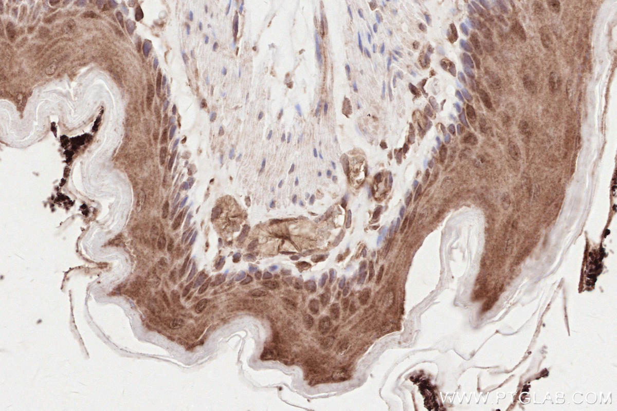 IHC staining of rat stomach using 25930-1-AP IHC staining of rat stomach using 25930-1-AP