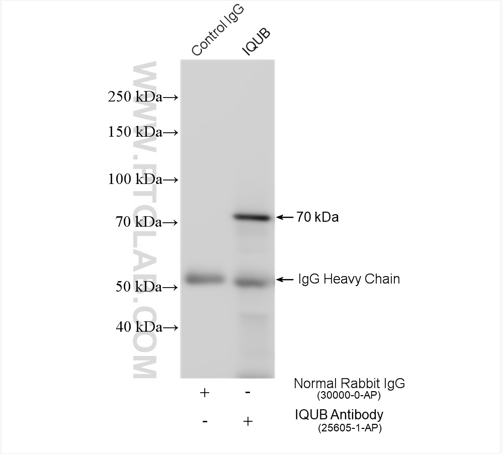 IP experiment of mouse spleen using 25605-1-AP
