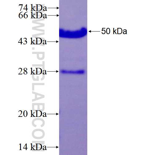 IQWD1 fusion protein Ag26645 SDS-PAGE IQWD1 fusion protein Ag26645 SDS-PAGE
