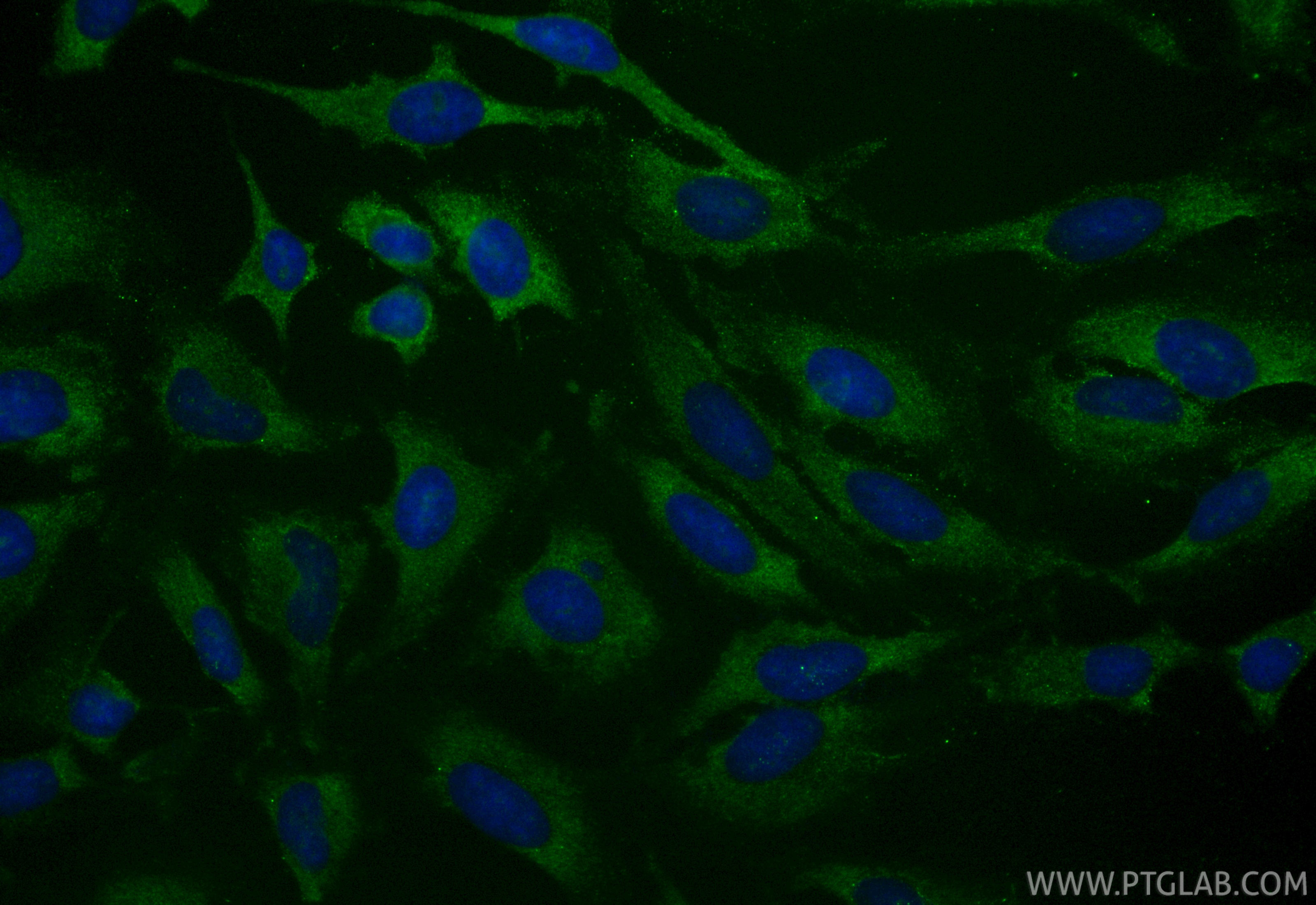 IF Staining of HeLa using CL488-86068-3
