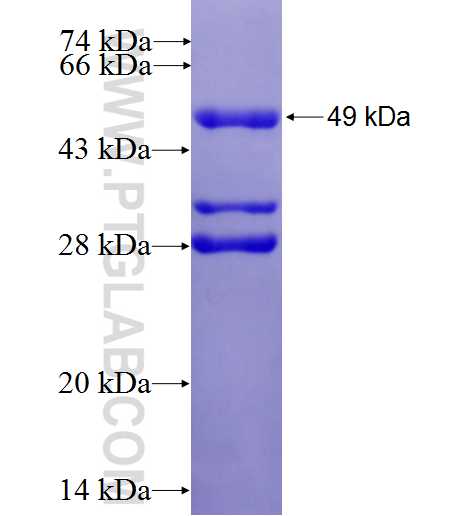 IRAK1 fusion protein Ag0728 SDS-PAGE