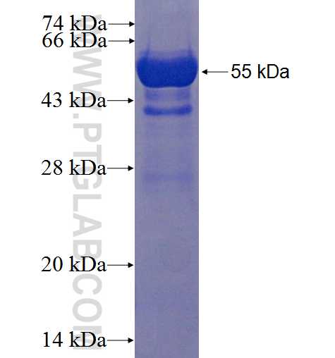IRAK1BP1 fusion protein Ag22654 SDS-PAGE