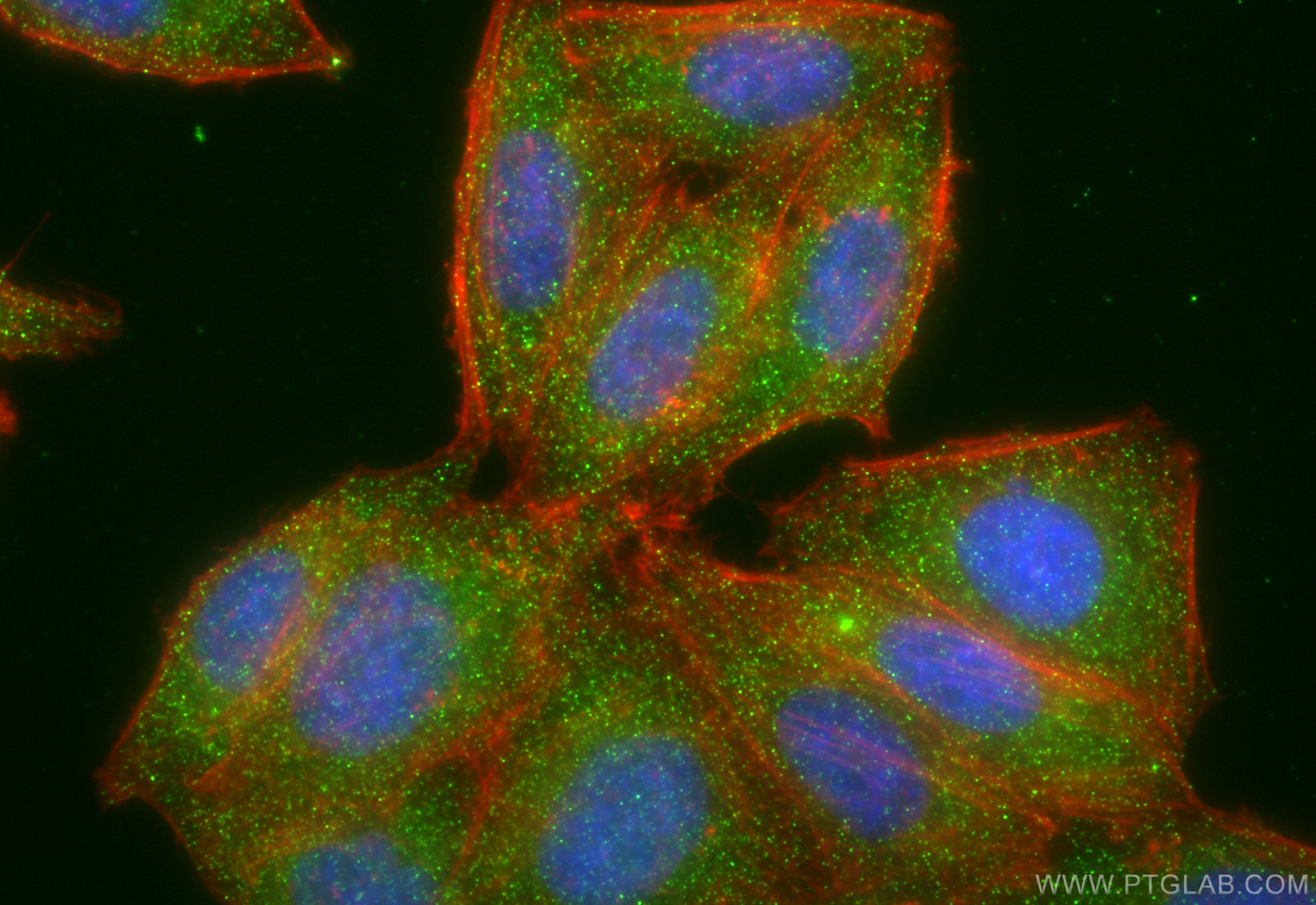 IF Staining of HepG2 using 67180-1-Ig