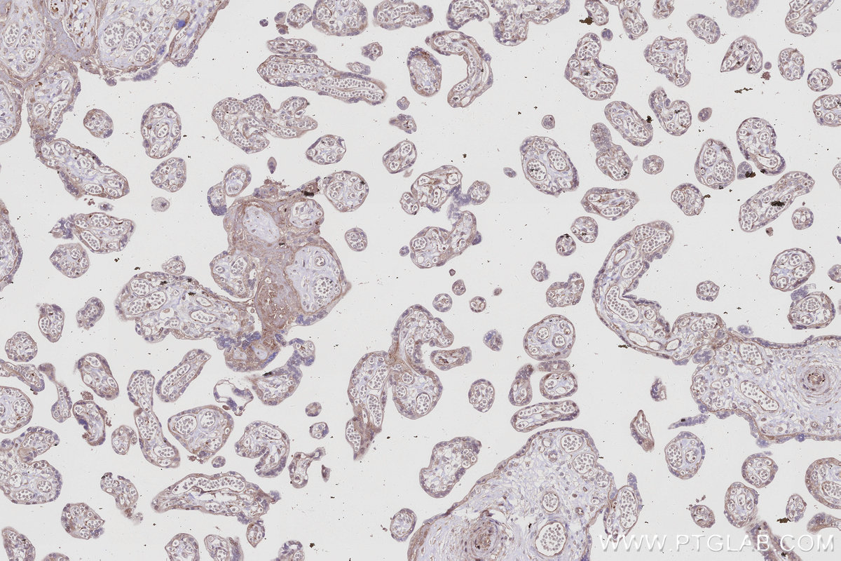 IHC staining of human placenta using 67180-1-Ig