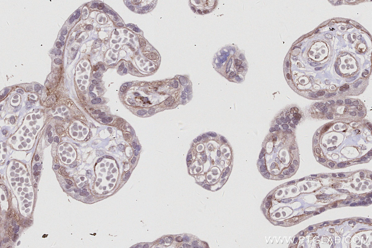 IHC staining of human placenta using 67180-1-Ig