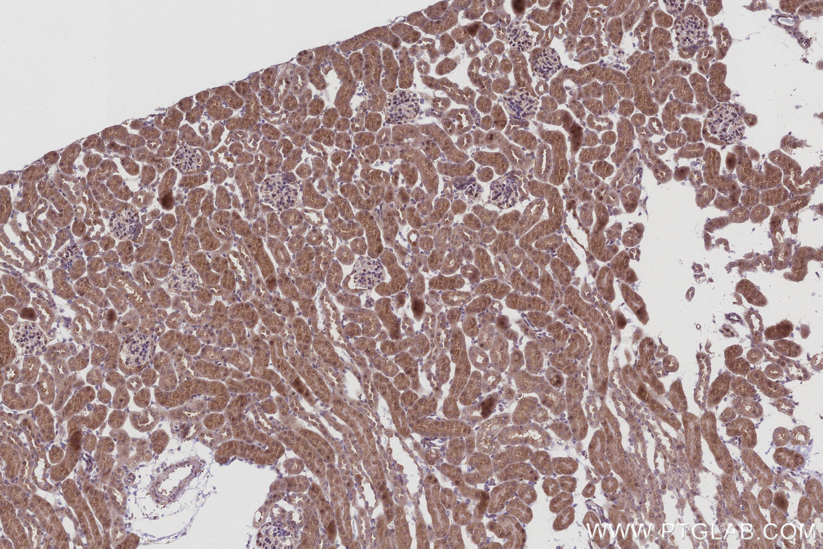 IHC staining of mouse kidney using 67180-1-Ig