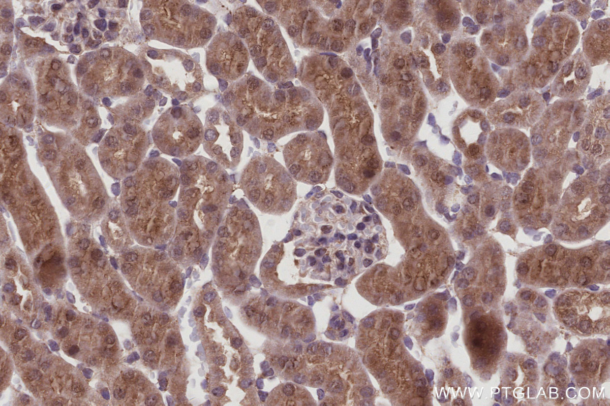 IHC staining of mouse kidney using 67180-1-Ig