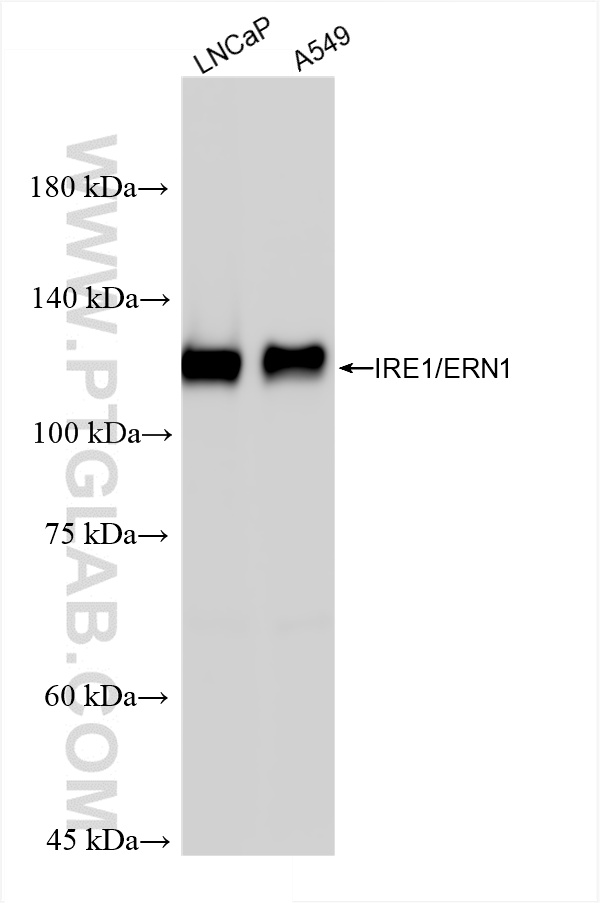 WB analysis using 82687-5-RR