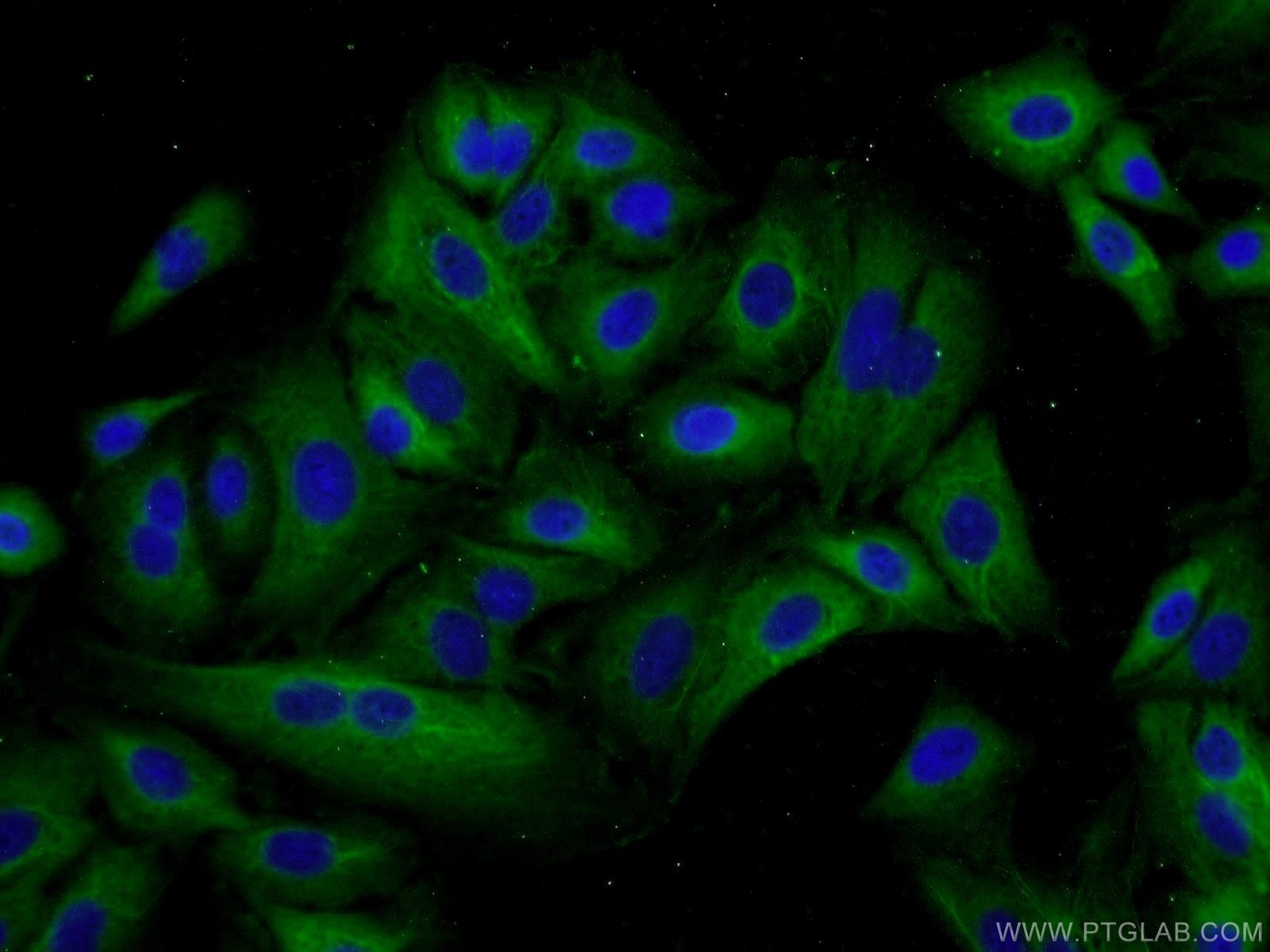 IF Staining of A549 using 23829-1-AP