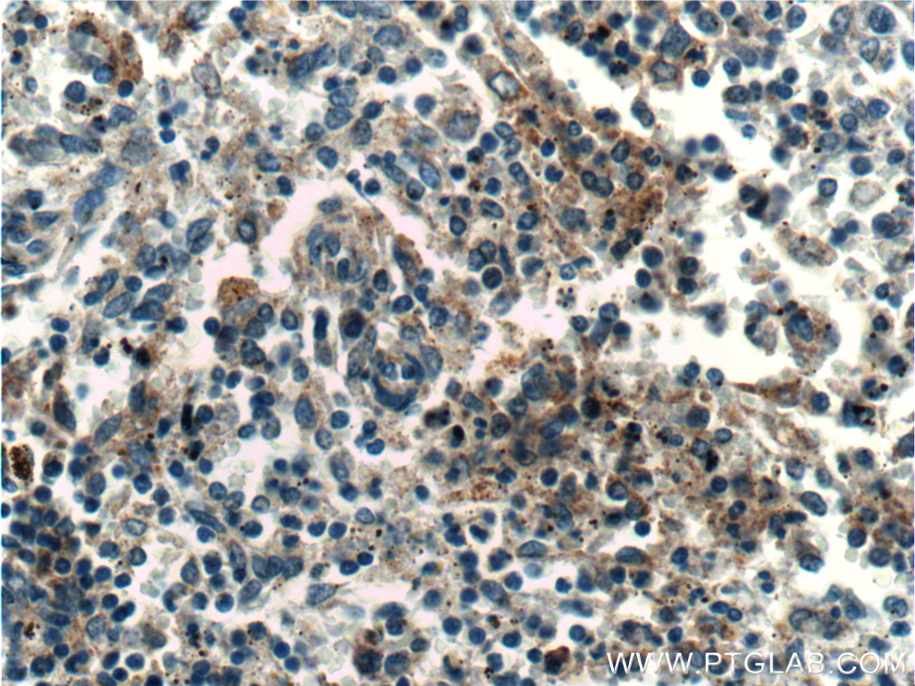 IHC staining of human spleen using 23829-1-AP