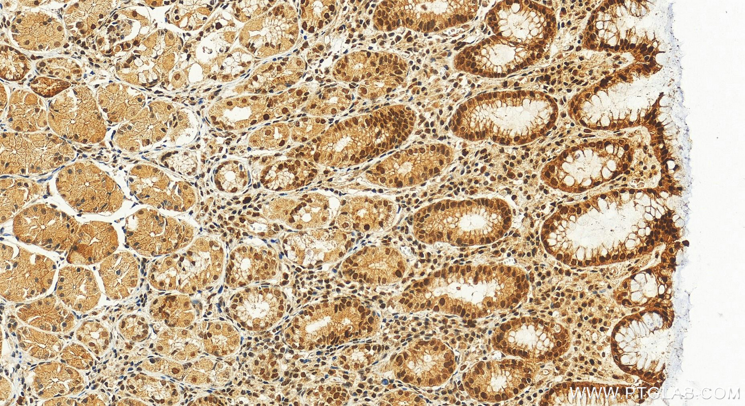 Immunohistochemical analysis of paraffin-embedded human stomach tissue slide using 11335-1-AP (IRF1 antibody) at dilution of 1:500 (under 20x lens). Heat mediated antigen retrieval with Tris-EDTA buffer (pH 9.0). IHC staining of human stomach using 11335-1-AP