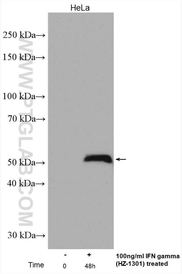 WB analysis using 11335-1-AP