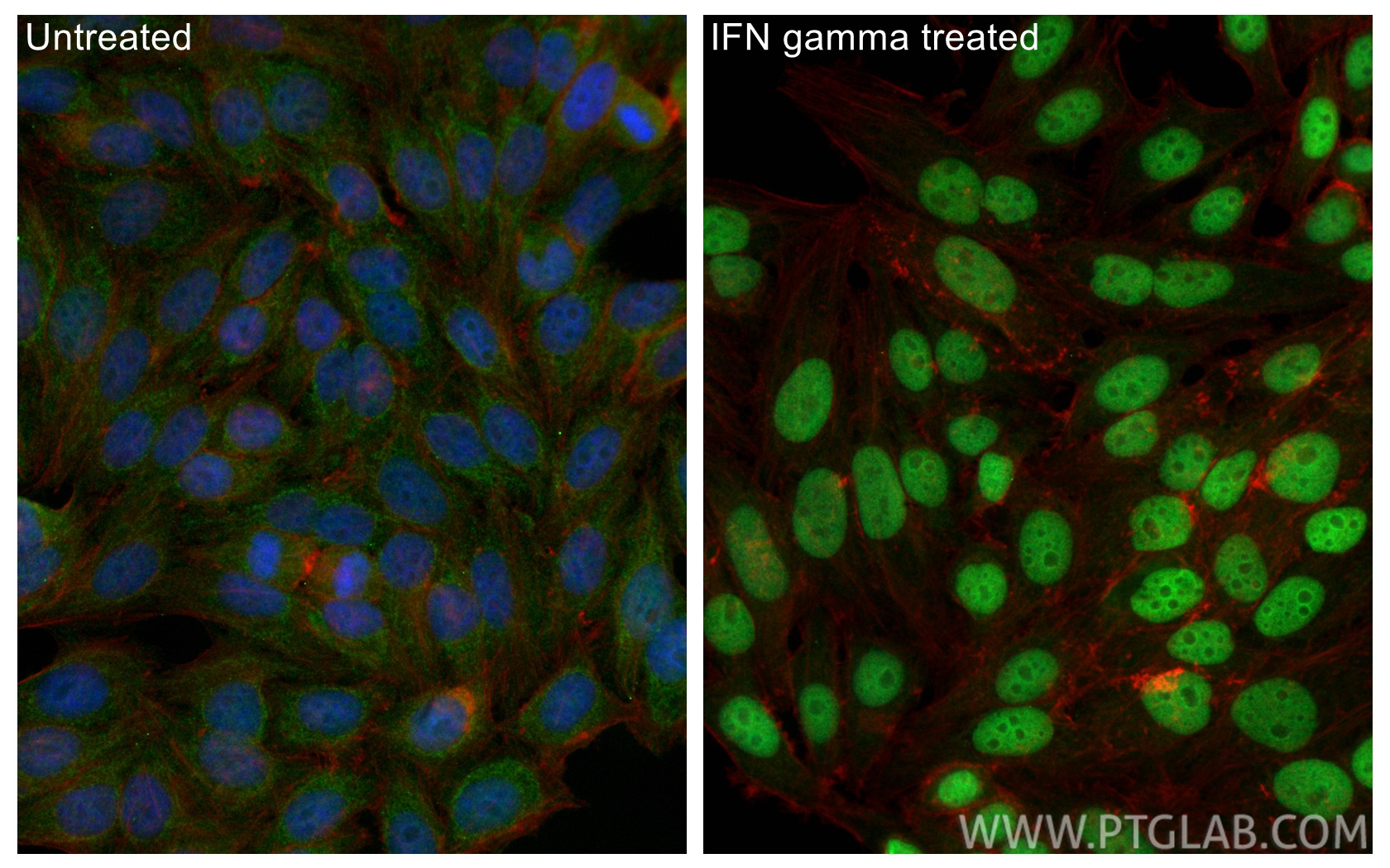 IF Staining of HepG2 using CL488-11335