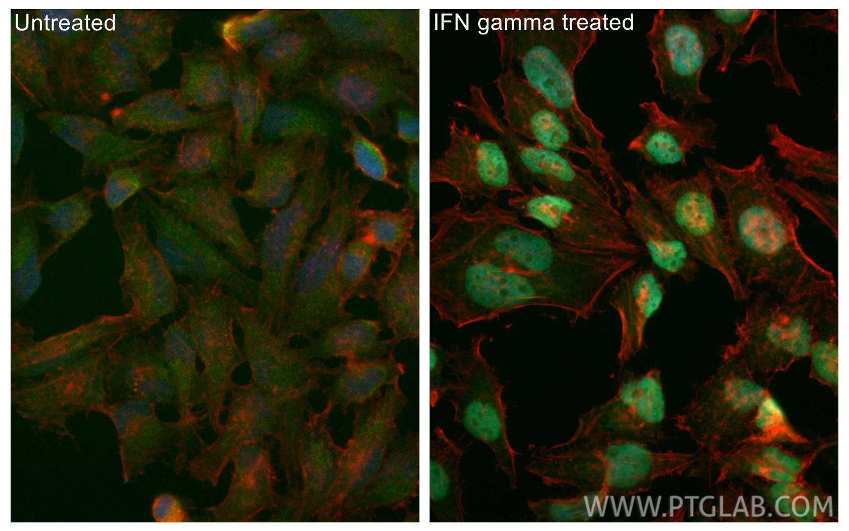 IF Staining of HeLa using CL488-85254-3 IF Staining of HeLa using CL488-85254-3