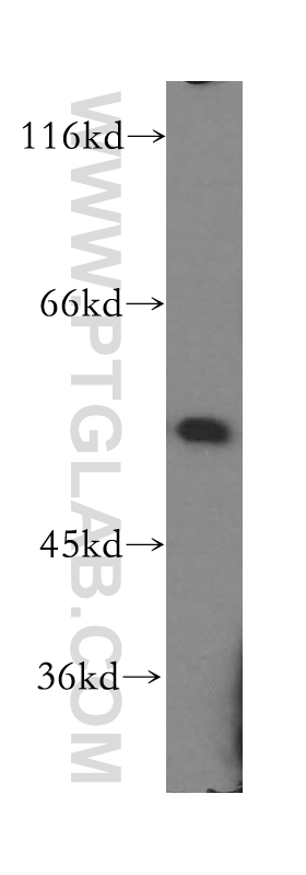 IRF2 Polyclonal antibody