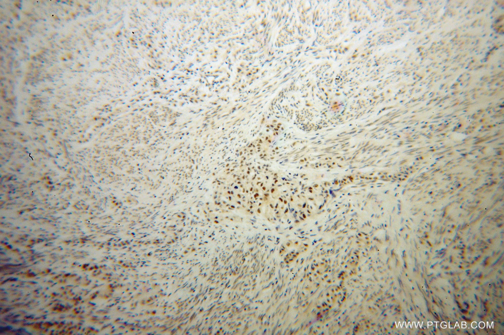 IRF2BP1