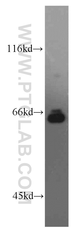 WB analysis of HeLa using 13698-1-AP