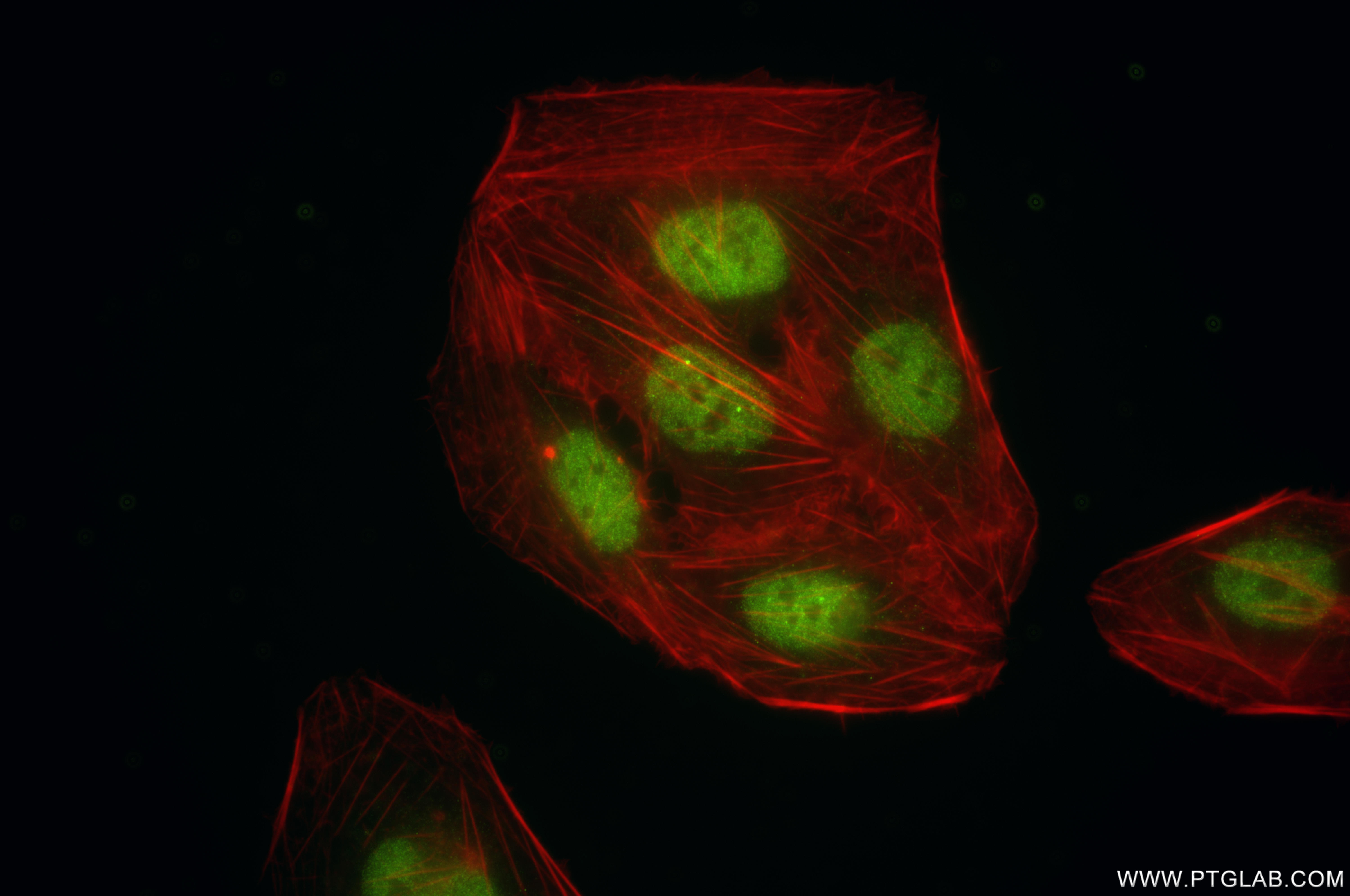 IF Staining of U2OS using 86048-1-RR (same clone as 86048-1-PBS)