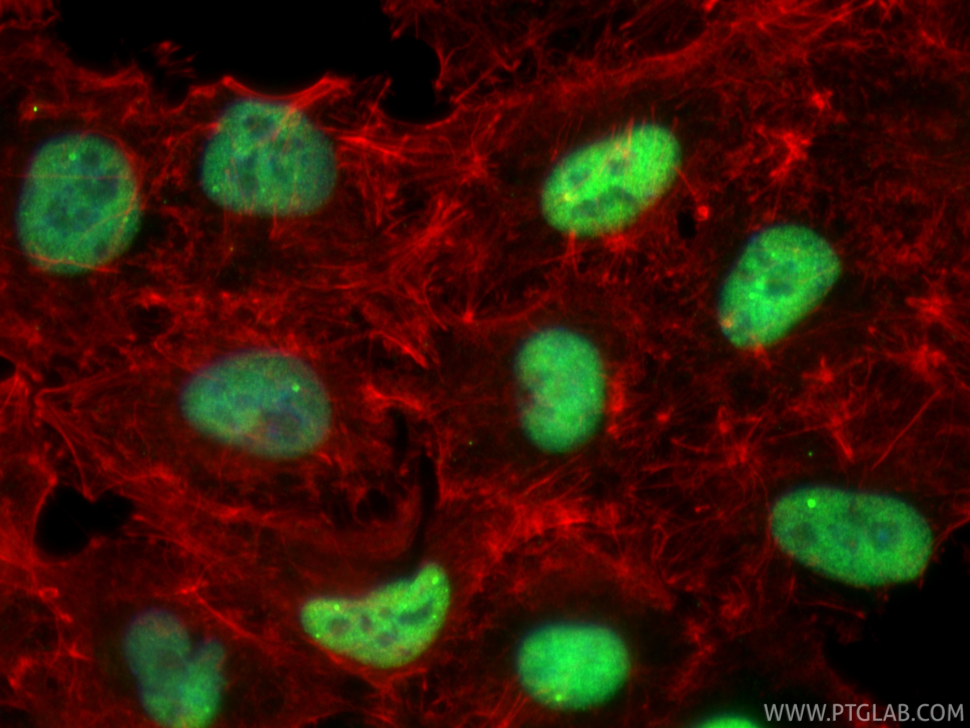 IF Staining of A549 using 61030-1-Ig IF Staining of A549 using 61030-1-Ig