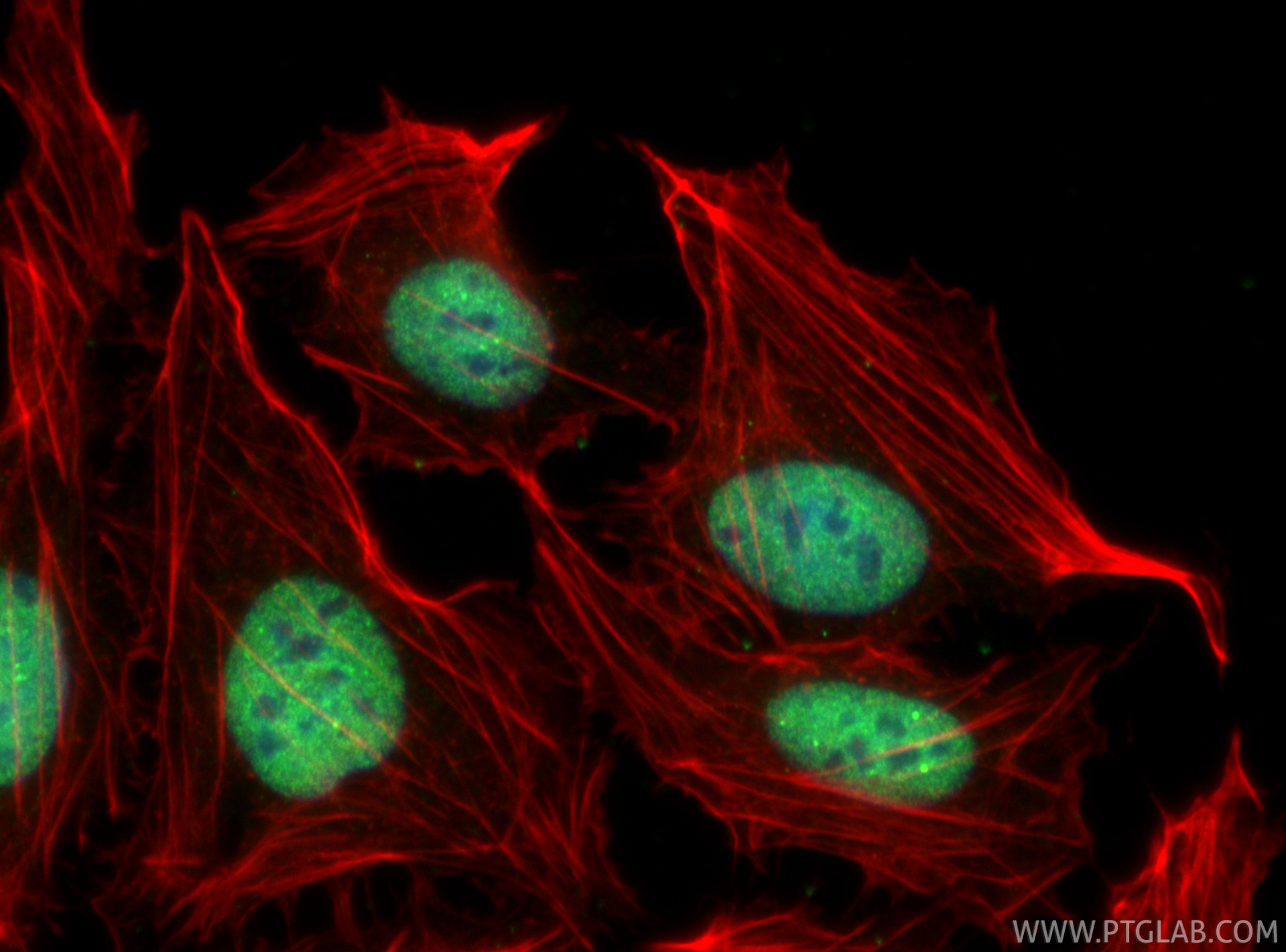IF Staining of U2OS using 61030-1-Ig IF Staining of U2OS using 61030-1-Ig