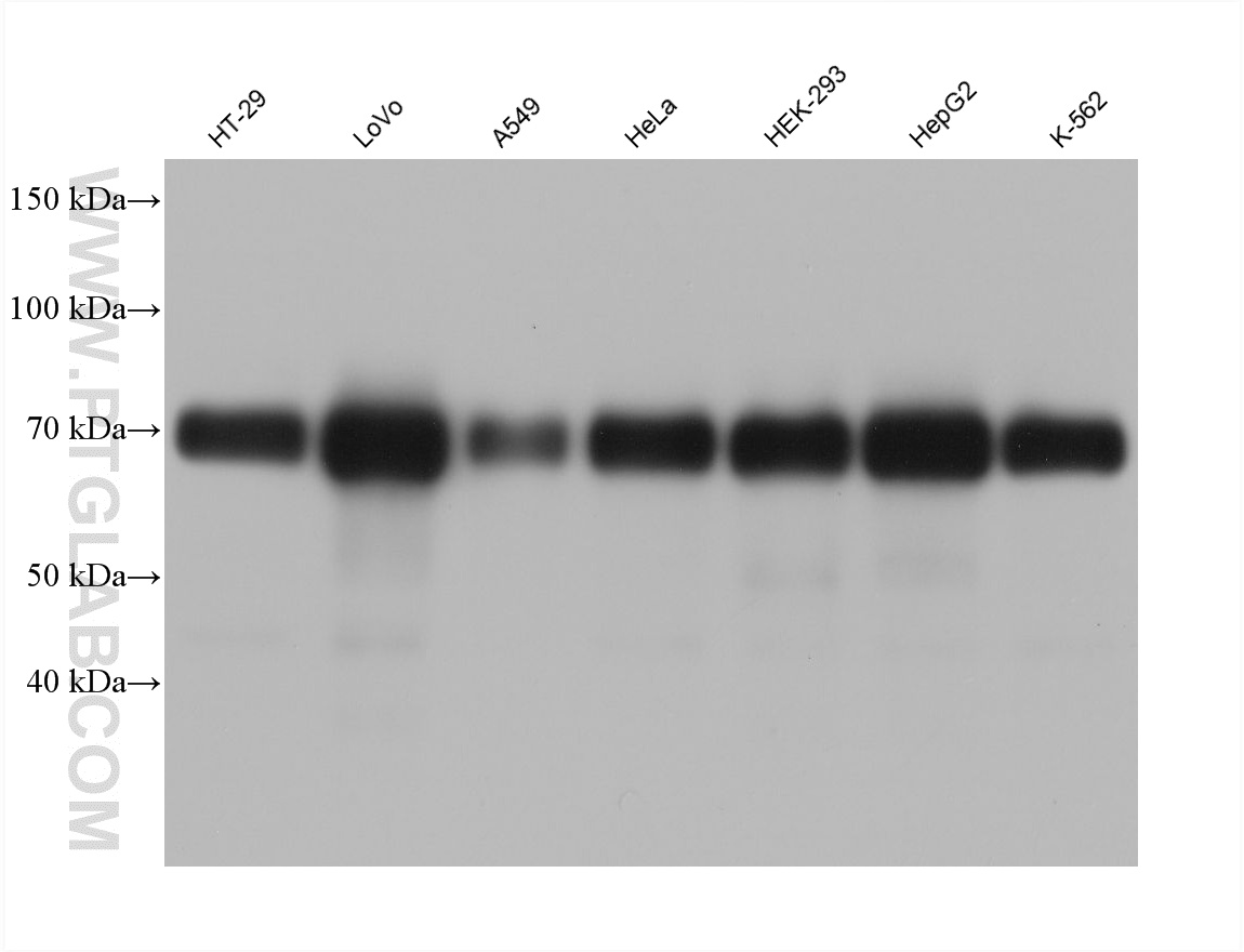WB analysis using 61030-1-Ig WB analysis using 61030-1-Ig