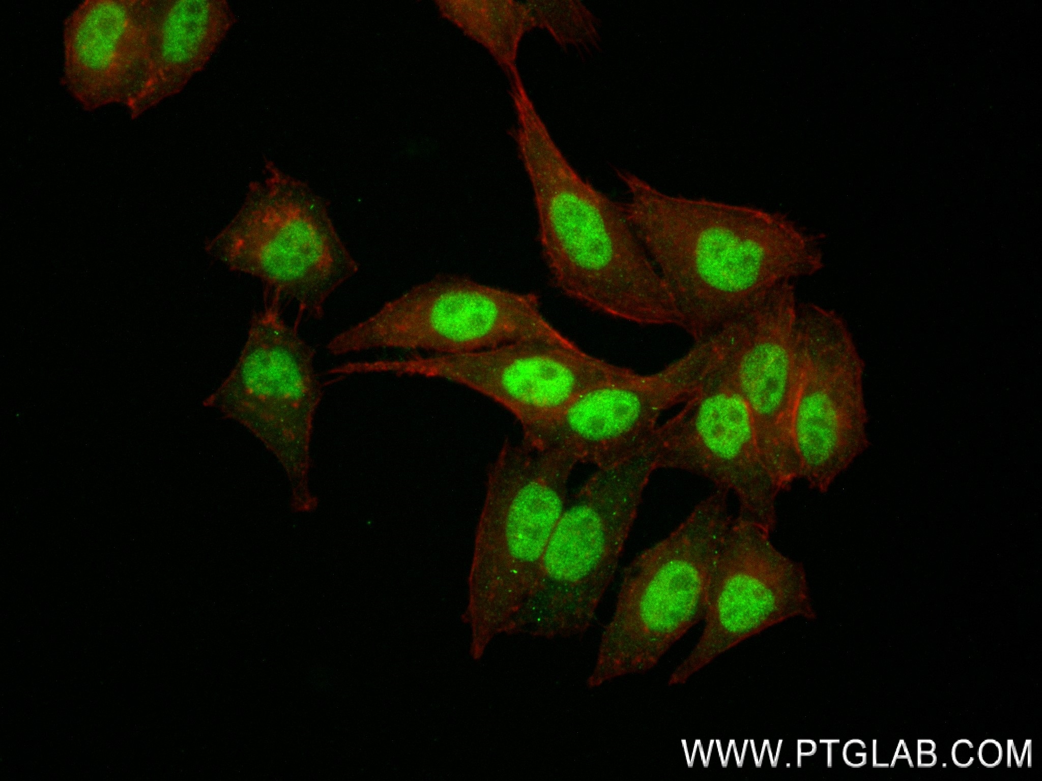 IF Staining of HepG2 using 84750-1-RR