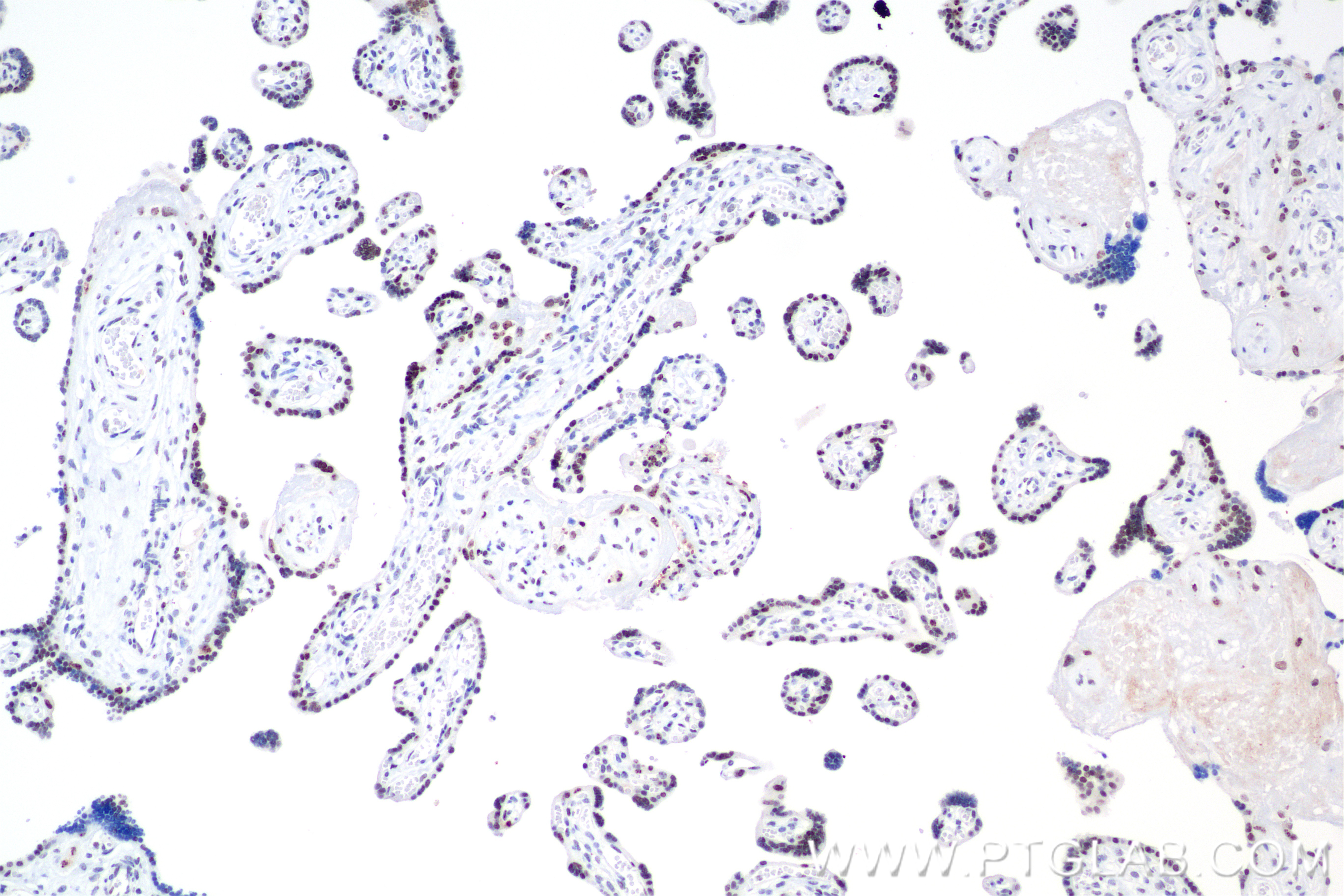 Immunohistochemical analysis of paraffin-embedded human placenta tissue slide using 84750-1-RR (IRF2BP2 antibody) at dilution of 1:1000 (under 10x lens). Heat mediated antigen retrieval with Tris-EDTA buffer (pH 9.0). IHC staining of human placenta using 84750-1-RR