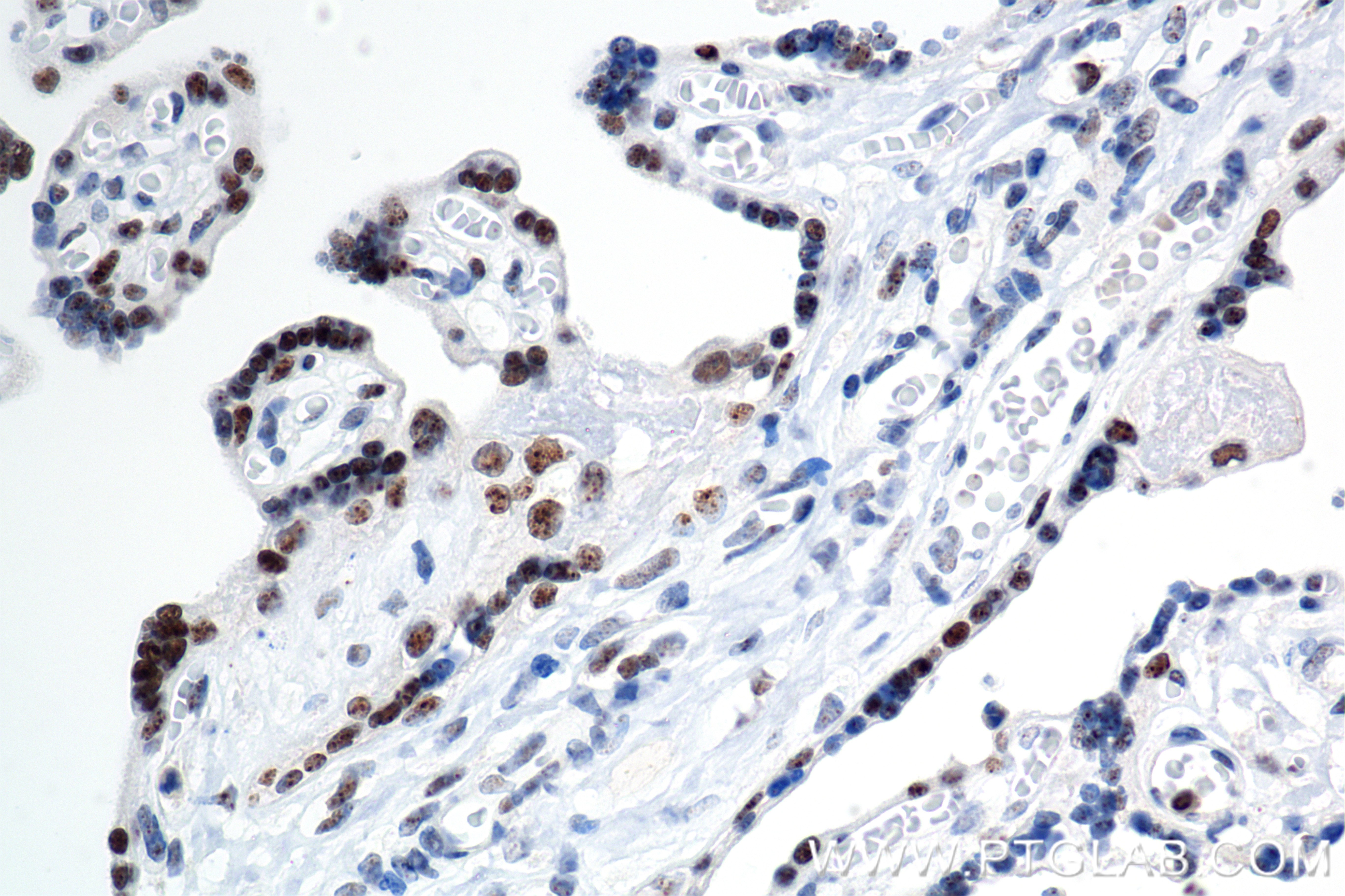 Immunohistochemical analysis of paraffin-embedded human placenta tissue slide using 84750-1-RR (IRF2BP2 antibody) at dilution of 1:1000 (under 40x lens). Heat mediated antigen retrieval with Tris-EDTA buffer (pH 9.0). IHC staining of human placenta using 84750-1-RR