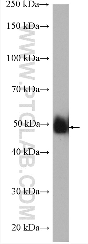 WB analysis of HeLa using 11312-1-AP