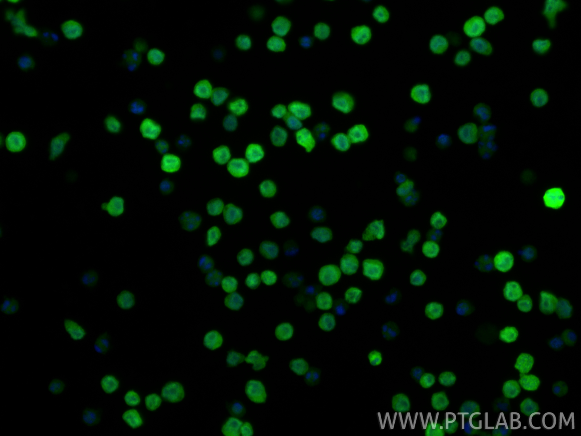 IF Staining of Ramos using 11247-2-AP IF Staining of Ramos using 11247-2-AP