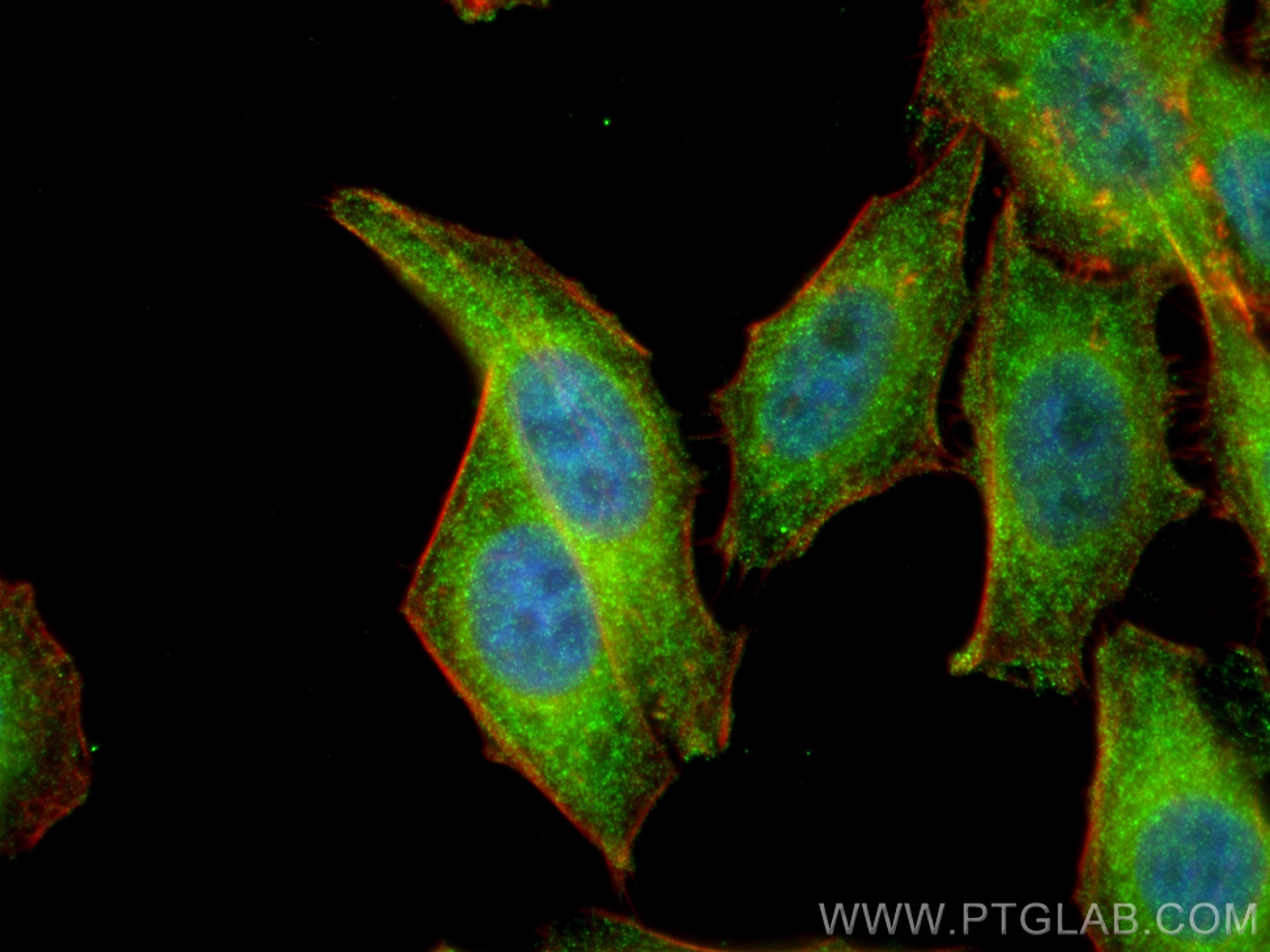 IF Staining of HepG2 using 10547-1-AP