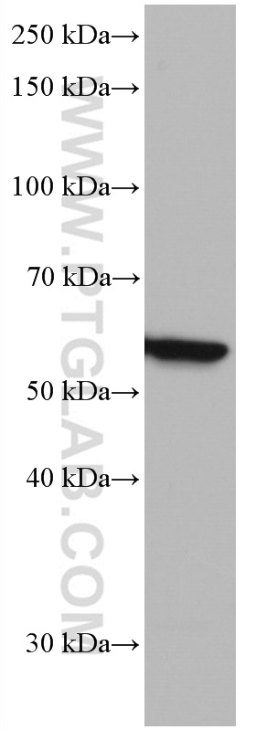 WB analysis of A549 using 66835-1-Ig